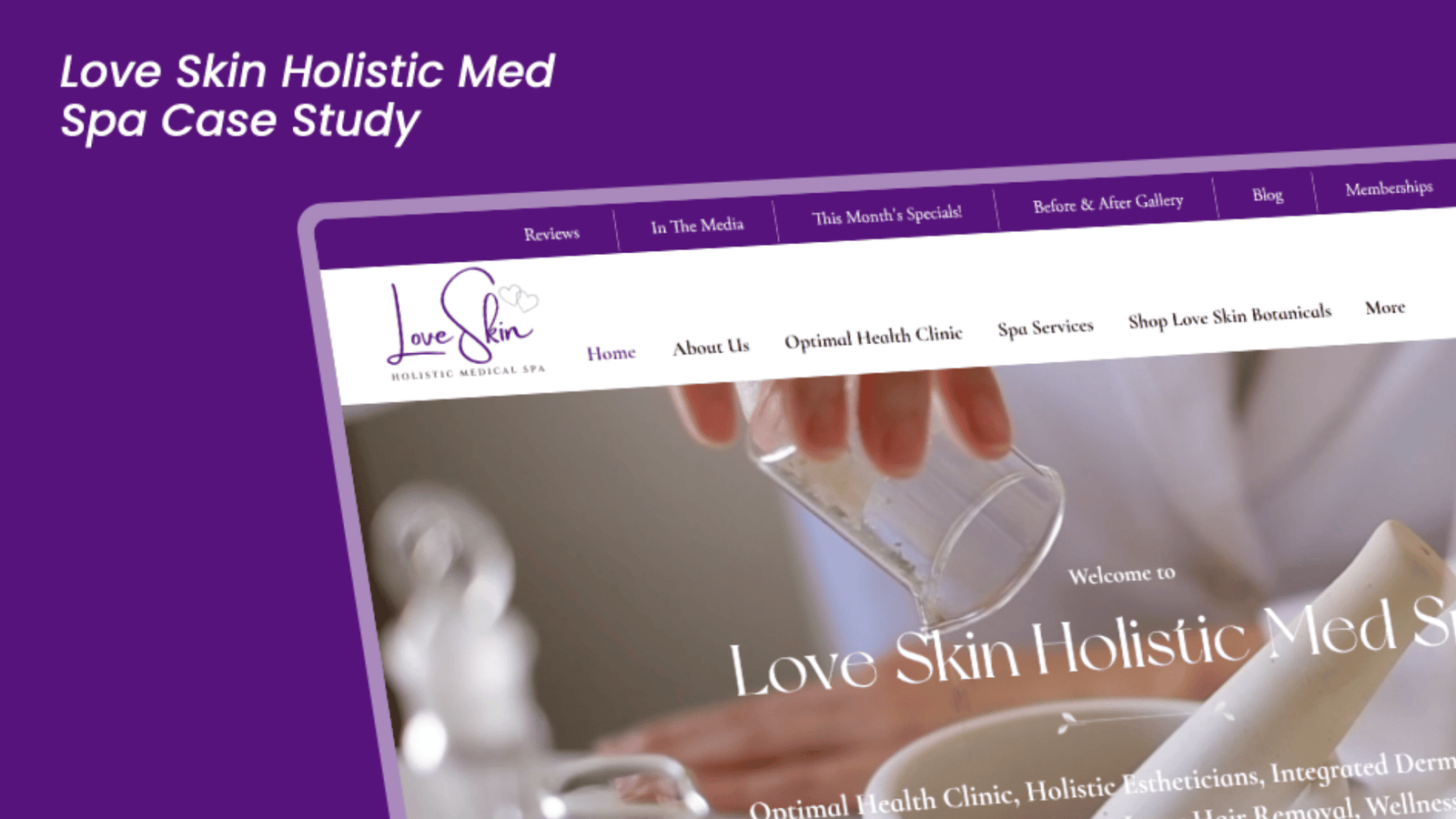love skin